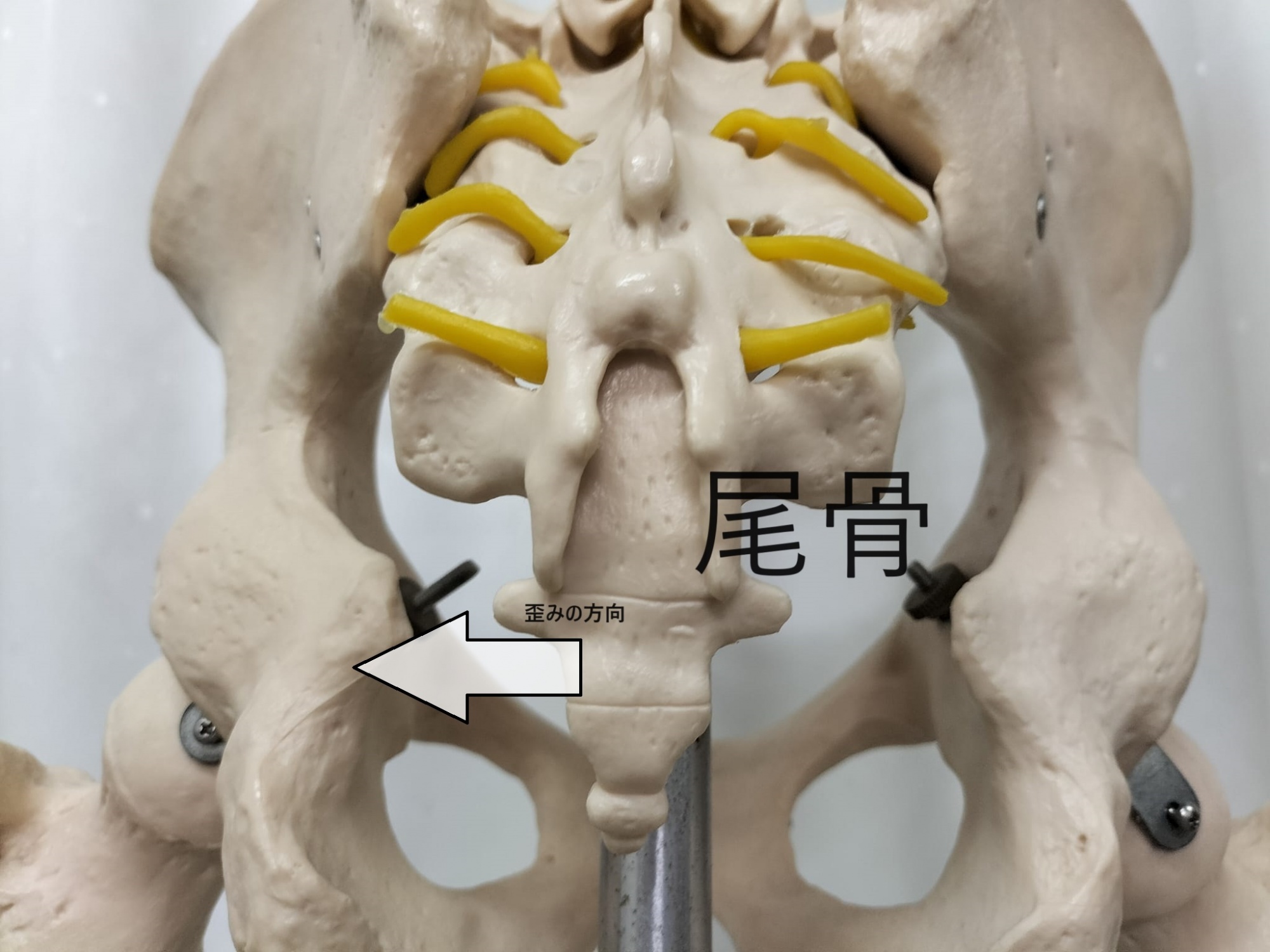 尾骨の歪み