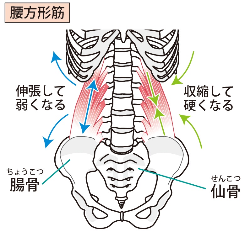 腰方形筋のイラスト